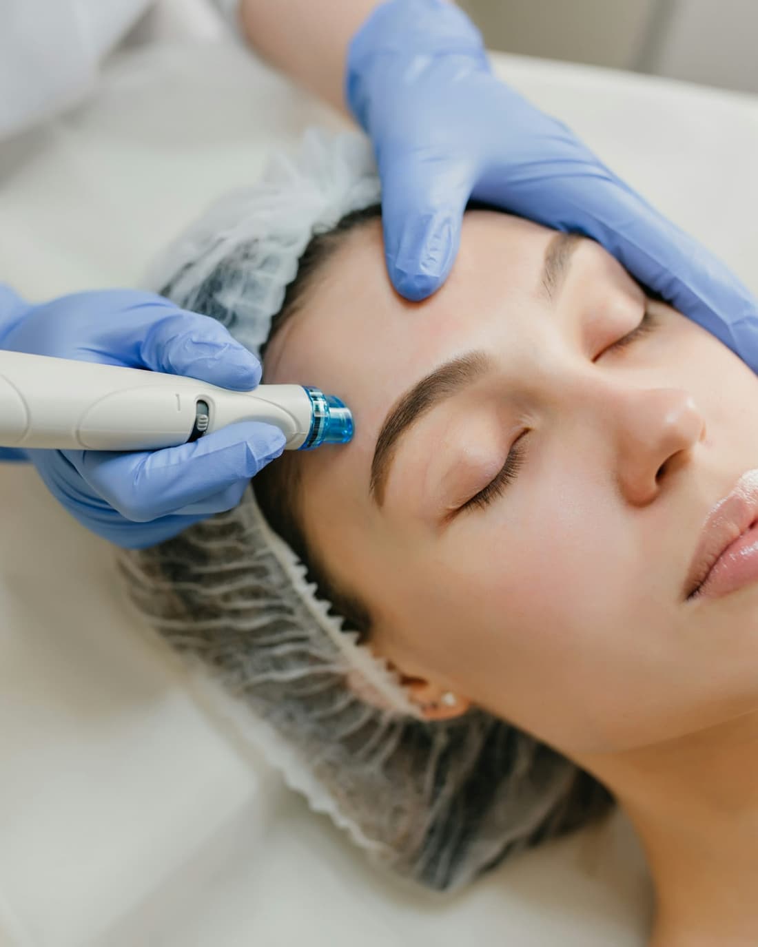 Client resting with her eyes closed as a provider in light blue gloves guides a hydradermabrasion handpiece across her forehead